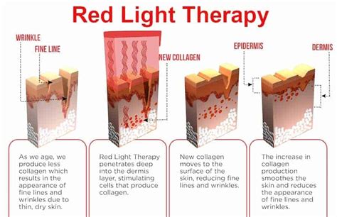 Red Therapy: Unlocking the Healing Power of Color
